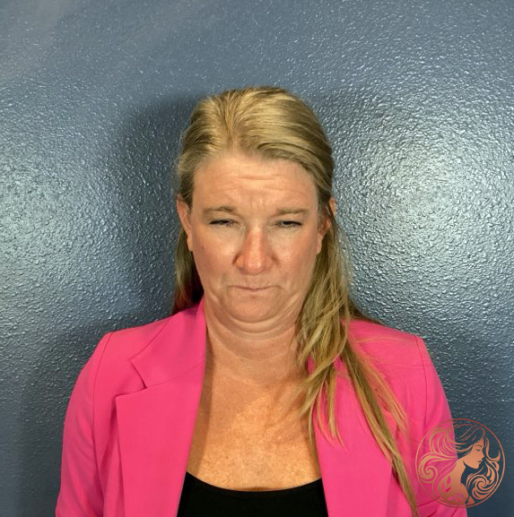 Botox before photo, patient #1, Viradia Plastic Surgery.