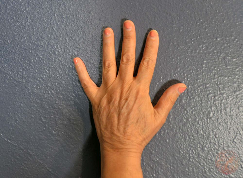 After showing overall rejuvenation and improved skin quality.