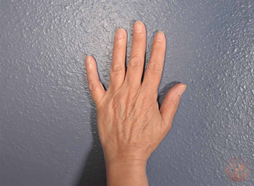 Before showing overall facial descent and skin aging.