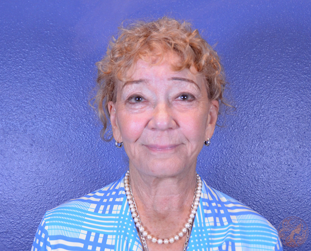 Deep plane facelift with neck lift and upper blepharoplasty, before treatment, front view showing facial sagging, jawline softening, and upper eyelid heaviness. Viradia Plastic Surgery.