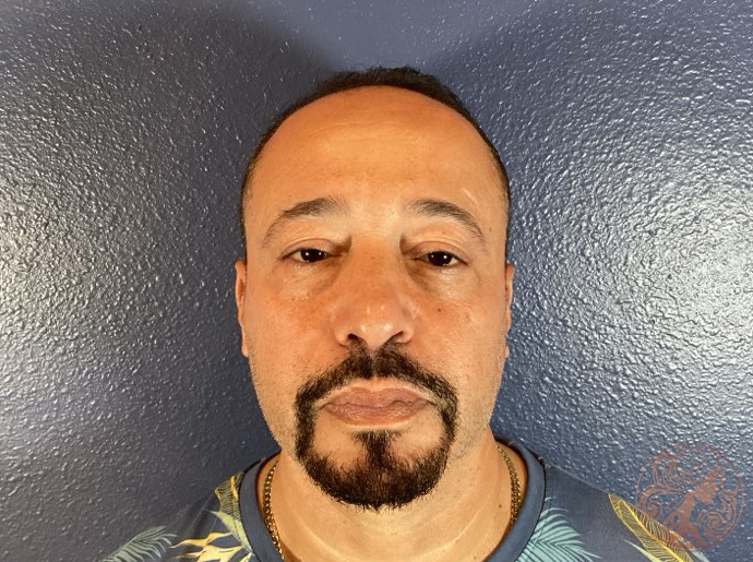 Upper and lower blepharoplasty, before treatment, angled view showing eyelid drooping and under-eye bags. Viradia Plastic Surgery.